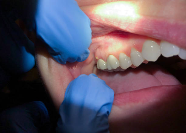 Best Emergency Root Canal Therapy in Ashburn, VA