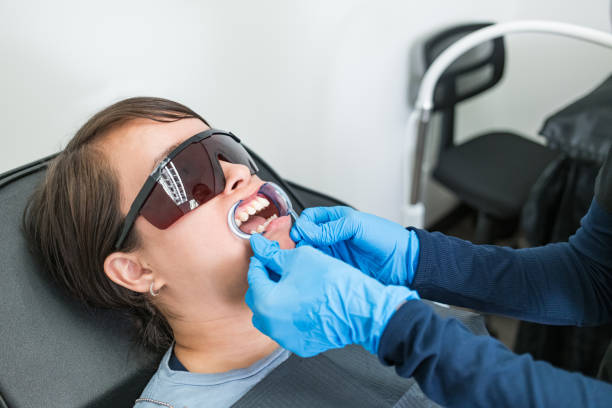 Best Knocked-Out Tooth (Avulsed Tooth) Treatment in Ashburn, VA